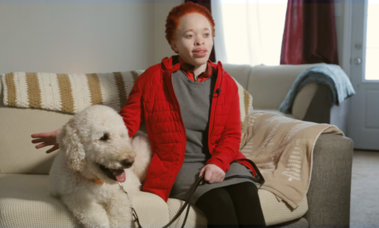 Image Credit: Patrick Leduc/CBC